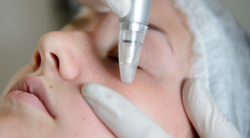 best at home microdermabrasion